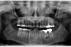 Evidence of an oversized crown on the bottom left.